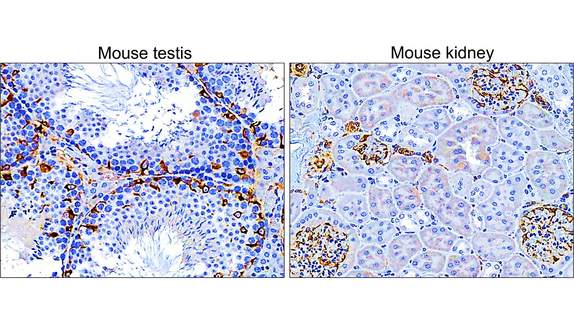 IR45-137 anti-Vimentin antibody IHC image IR45-137 anti-Vimentin antibody IHC image