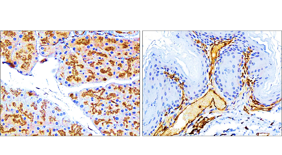 IR45-137 anti-Vimentin antibody IHC image IR45-137 anti-Vimentin antibody IHC image