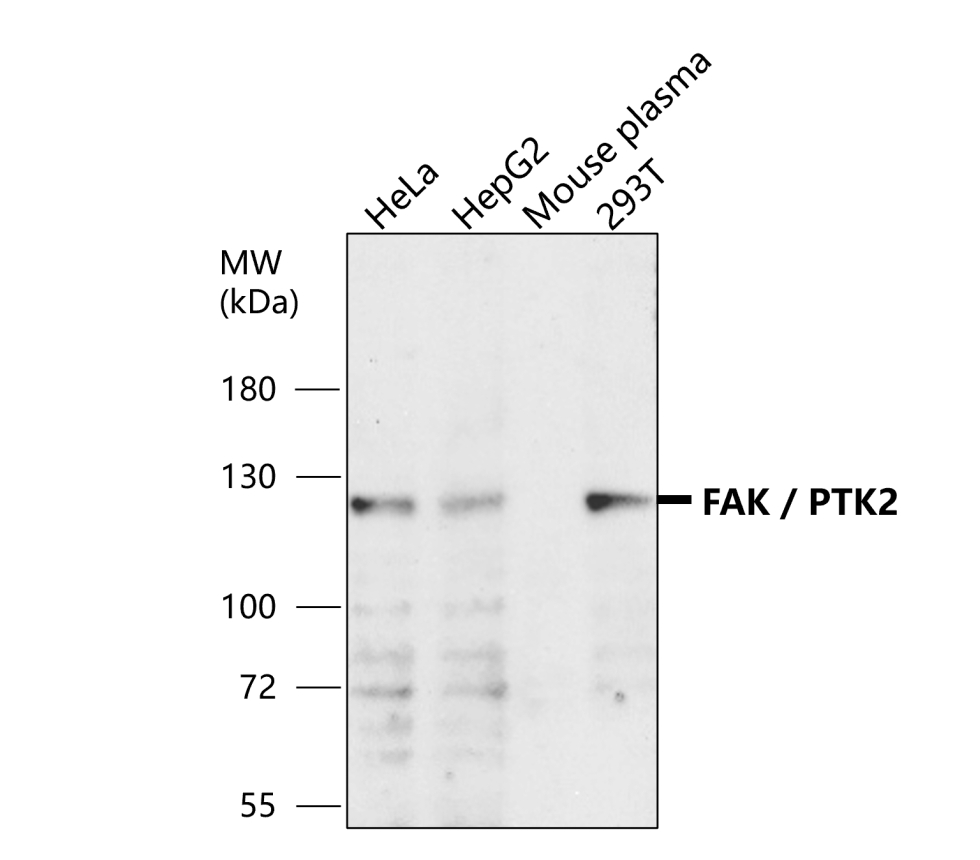 IR58-200 anti-FAK / PTK2 antibody WB image IR58-200 anti-FAK / PTK2 antibody WB image