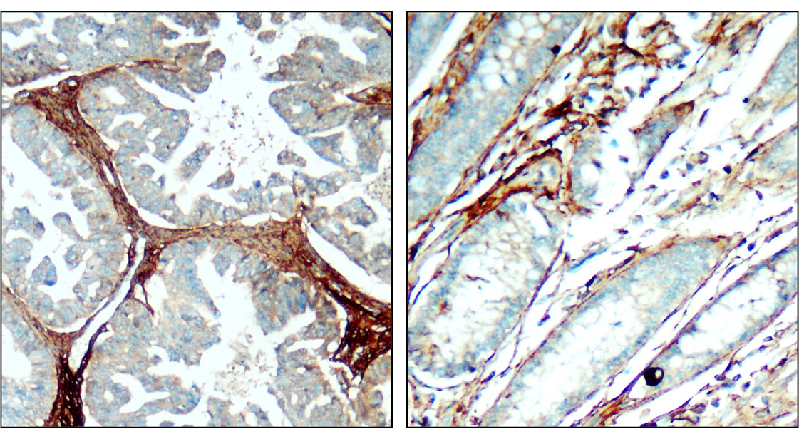 IR48-138 anti-Fibronectin antibody IHC image