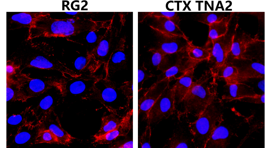 IR49-149 anti-Beta Catenin antibody IHC image