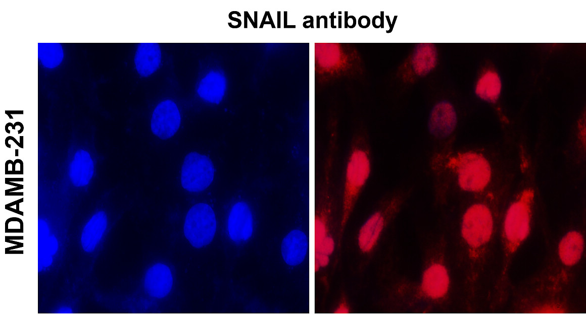 IR53-167 anti-ZEB1 antibody ICC/IF image IR53-167 anti-ZEB1 antibody ICC/IF image