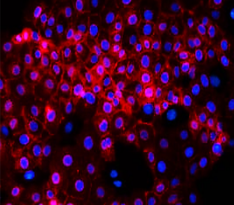 Customer feedback Image IR55-180 anti-E cadherin antibody ICC/IF image Customer feedback Image IR55-180 anti-E cadherin antibody ICC/IF image