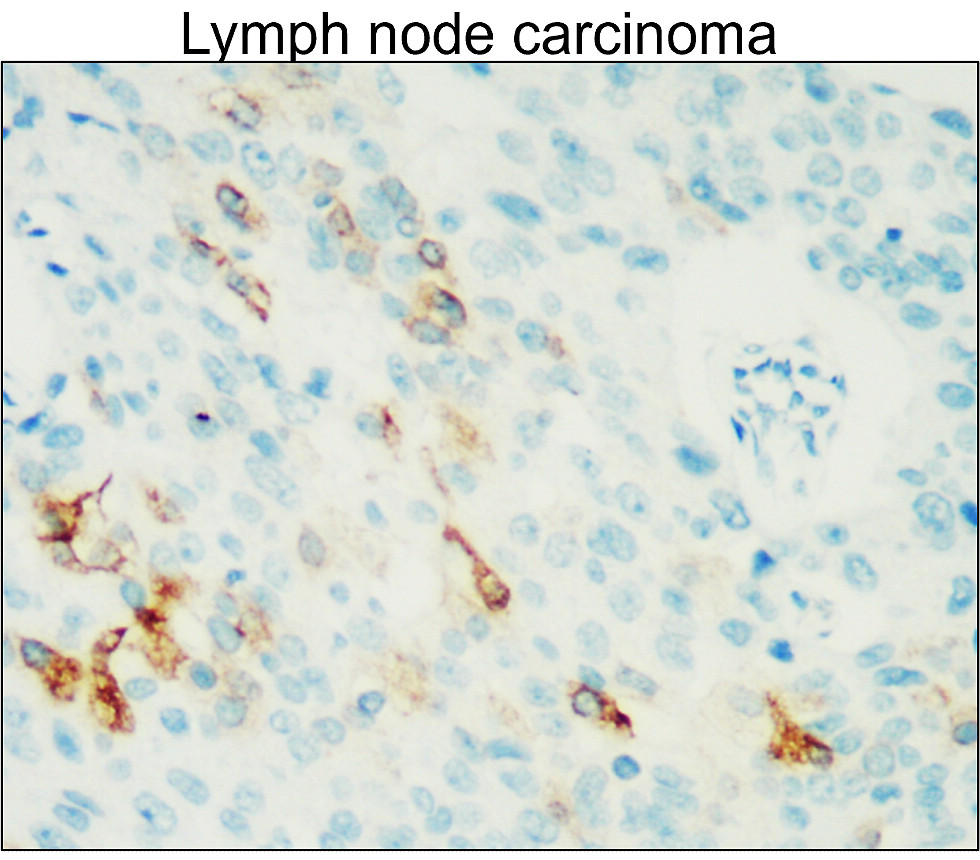 IR109-446 anti-COX2 antibody  IHC image