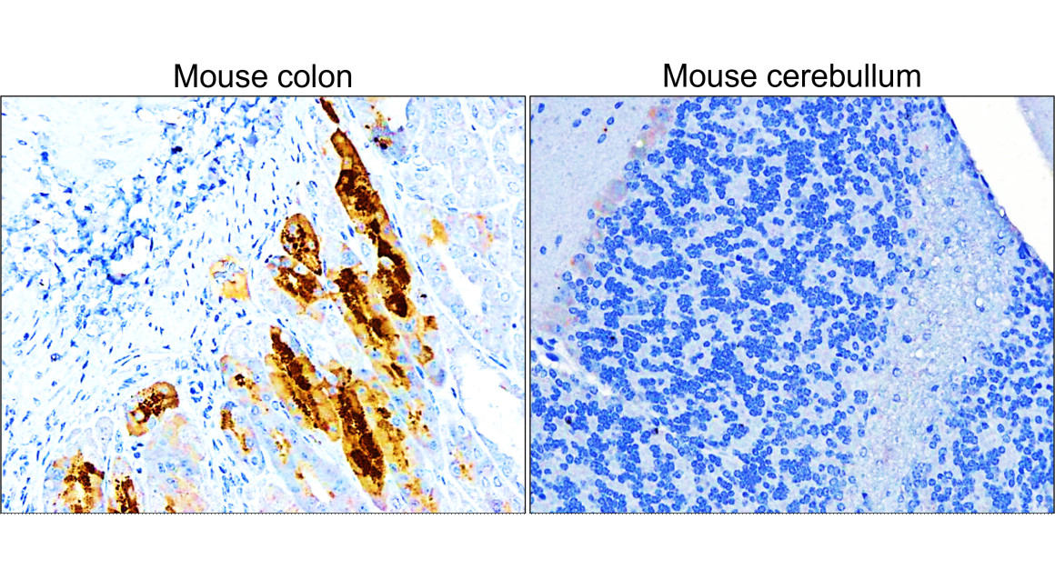 IR109-446 anti-COX2 antibody IHC image IR109-446 anti-COX2 antibody IHC image