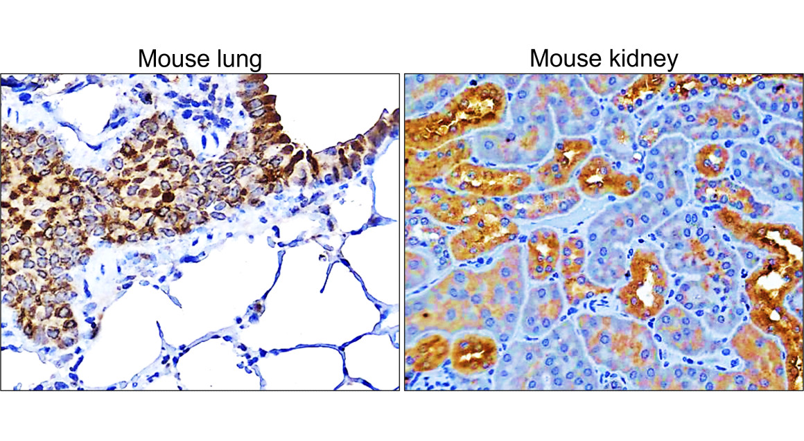 IR109-446 anti-COX2 antibody IHC image IR109-446 anti-COX2 antibody IHC image