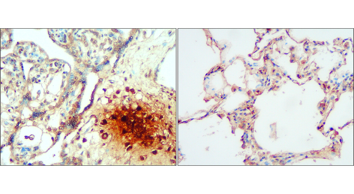 IR114-473 anti-IL1 beta antibody IHC image