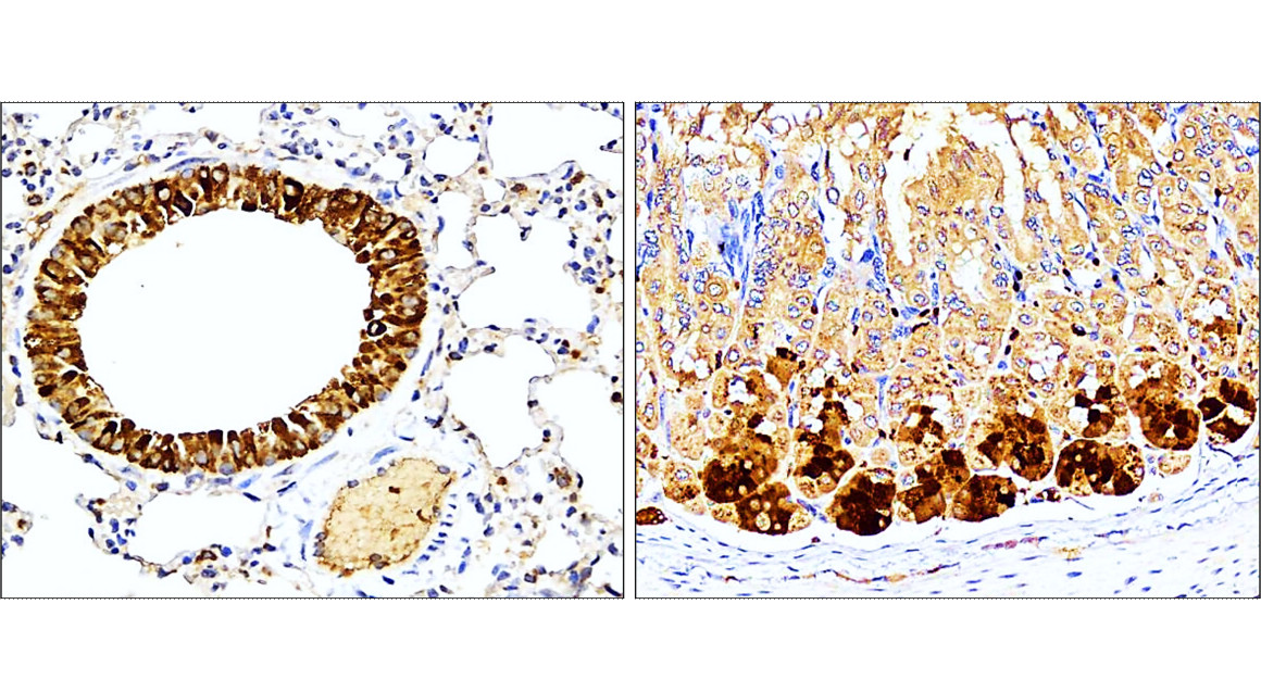 IR114-473 anti-IL1 beta antibody IHC image