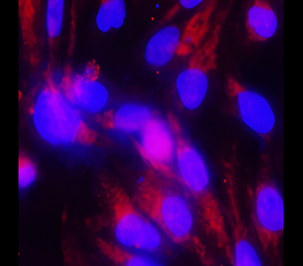 IR57-193 anti-Occludin antibody ICC/IF image IR57-193 anti-Occludin antibody ICC/IF image