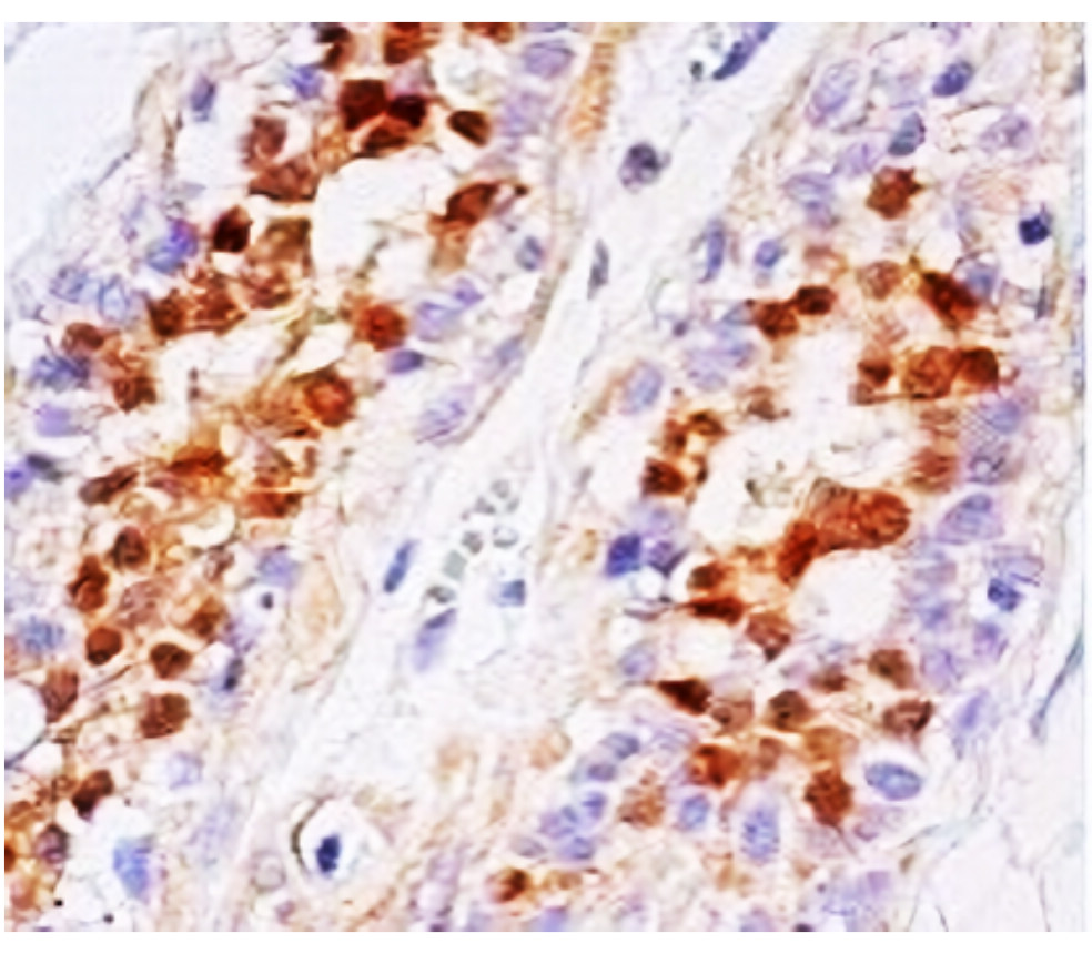 IRM010 anti-STAT5 monoclonal antibody IHC image IRM010 anti-STAT5 monoclonal antibody IHC image