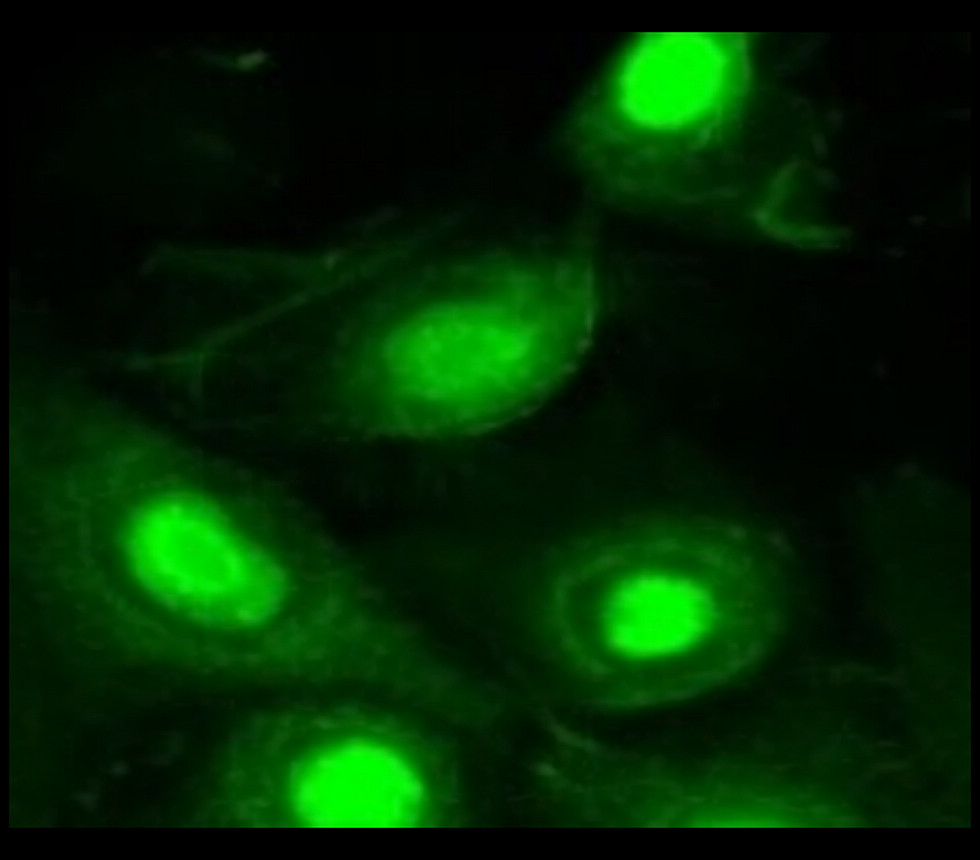 IRM010 anti-STAT5 monoclonal antibody ICC/IF image IRM010 anti-STAT5 monoclonal antibody ICC/IF image