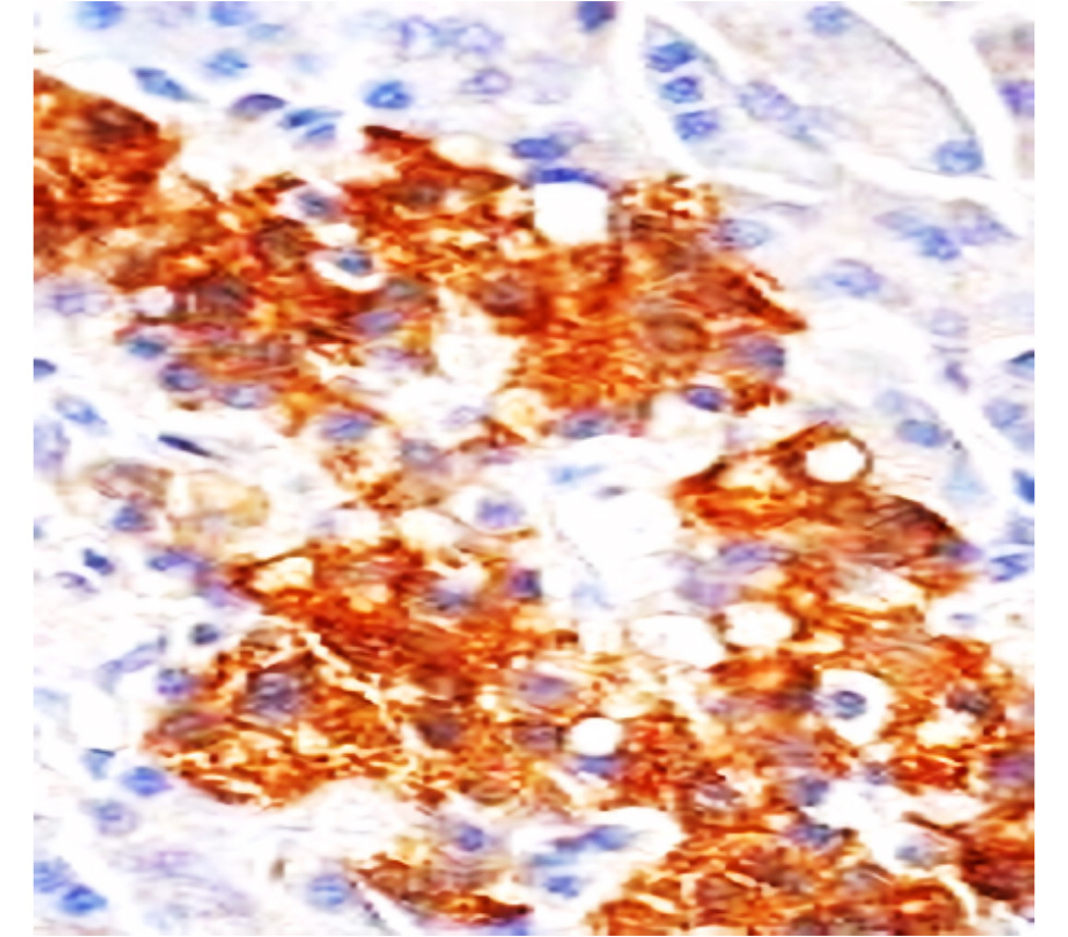 IRM009 anti-AKT monoclonal antibody IHC image IRM009 anti-AKT monoclonal antibody IHC image