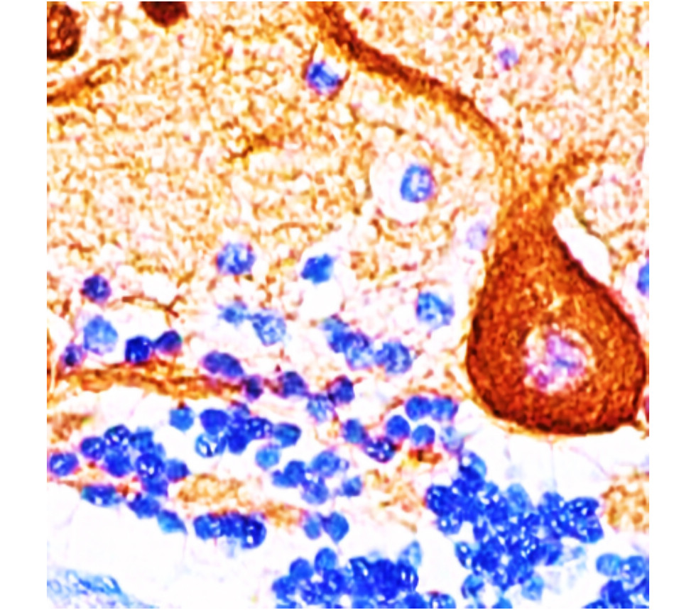 IRM008 anti-Tuj1 monoclonal antibody IHC image IRM008 anti-Tuj1 monoclonal antibody IHC image