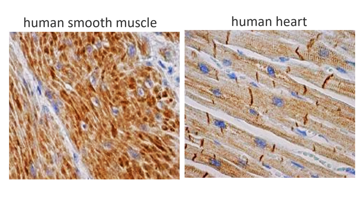 IRM006 anti-Desmin antibody IHC image