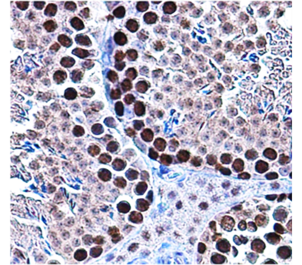 Customer feedback Image IRM002 anti-PCNA antibody IHC image