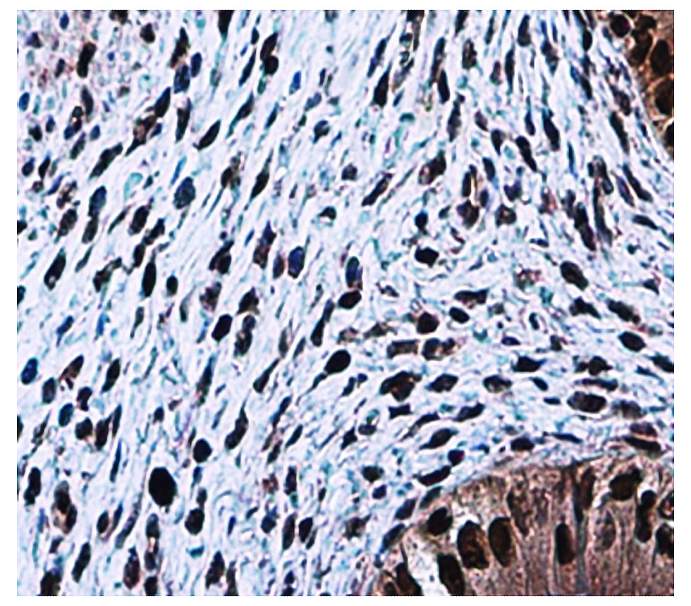 Customer feedback Image IRM002 anti-PCNA antibody IHC image