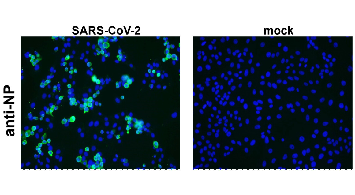 IRCR007 anti-SARS-CoV-2 nucleocapsid protein antibody ICC/IF image IRCR007 anti-SARS-CoV-2 nucleocapsid protein antibody ICC/IF image