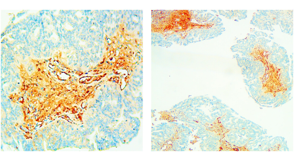 IRCP014 anti-AMH (Mullerian hormone) antibody IHC image IRCP014 anti-AMH (Mullerian hormone) antibody IHC image