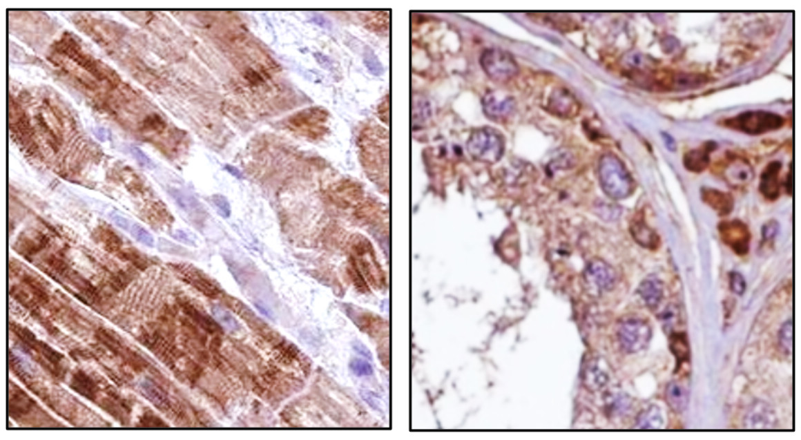 Customer feedback IRCP011 anti FNDC5 / irisin antibody IHC image Customer feedback IRCP011 anti FNDC5 / irisin antibody IHC image