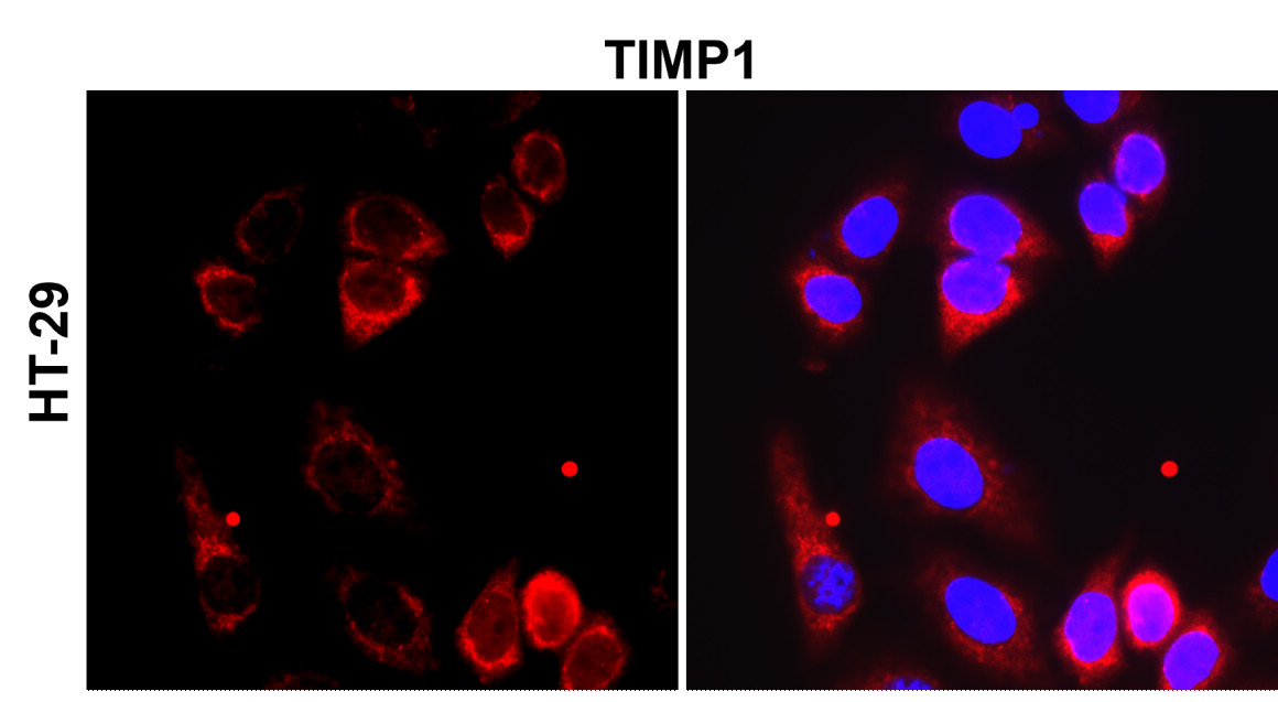 IR72-249 anti-TIMP1 antibody_HT-29 ICC/IF image IR72-249 anti-TIMP1 antibody_HT-29 ICC/IF image