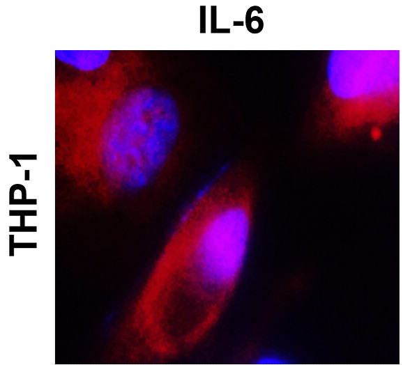 IR74-P1 anti-IL6 antibody ICC/IF image IR74-P1 anti-IL6 antibody ICC/IF image