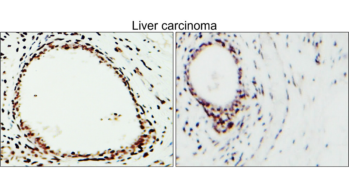 IR75-257 anti-CD31/PECAM1 antibody IHC image IR75-257 anti-CD31/PECAM1 antibody IHC image