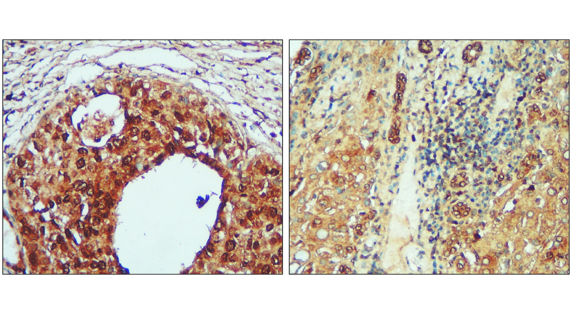 IR324-1020 anti- Toll-like Receptor 4 antibody IHC image IR324-1020 anti- Toll-like Receptor 4 antibody IHC image