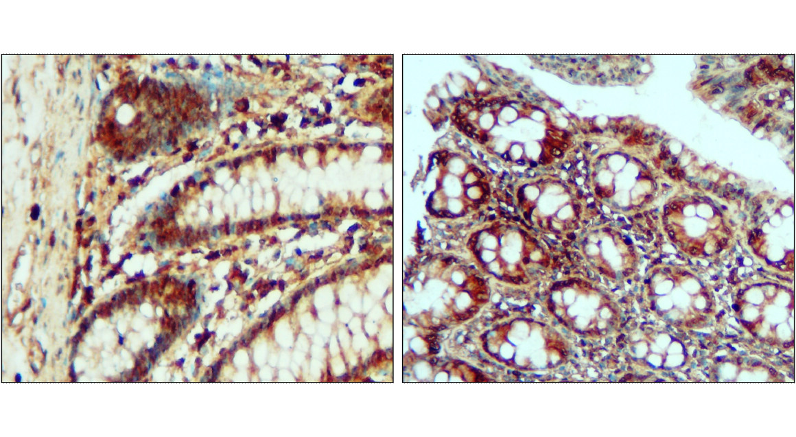 IR324-1020 anti- Toll-like Receptor 4 antibody IHC image IR324-1020 anti- Toll-like Receptor 4 antibody IHC image