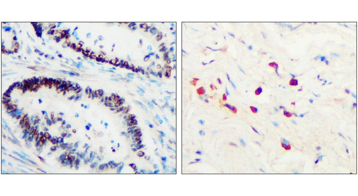 IR323-1016 anti- Toll-like Receptor 3 antibody IHC image IR323-1016 anti- Toll-like Receptor 3 antibody IHC image