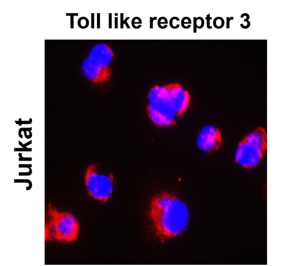 IR323-1016 anti- Toll-like Receptor 3 antibody ICC/IF image IR323-1016 anti- Toll-like Receptor 3 antibody ICC/IF image