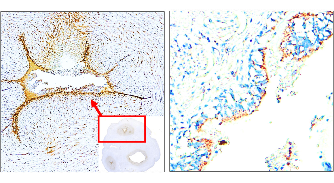 IR308-917 anti E-selectin / CD62E antibody IHC image IR308-917 anti E-selectin / CD62E antibody IHC image