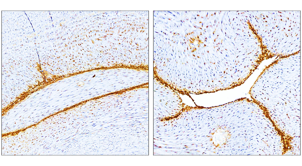 IR308-917 anti E-selectin / CD62E antibody IHC image