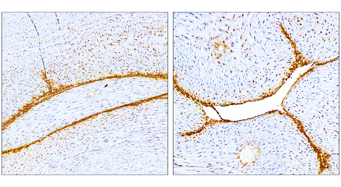IR308-917 anti E-selectin / CD62E antibody IHC image IR308-917 anti E-selectin / CD62E antibody IHC image