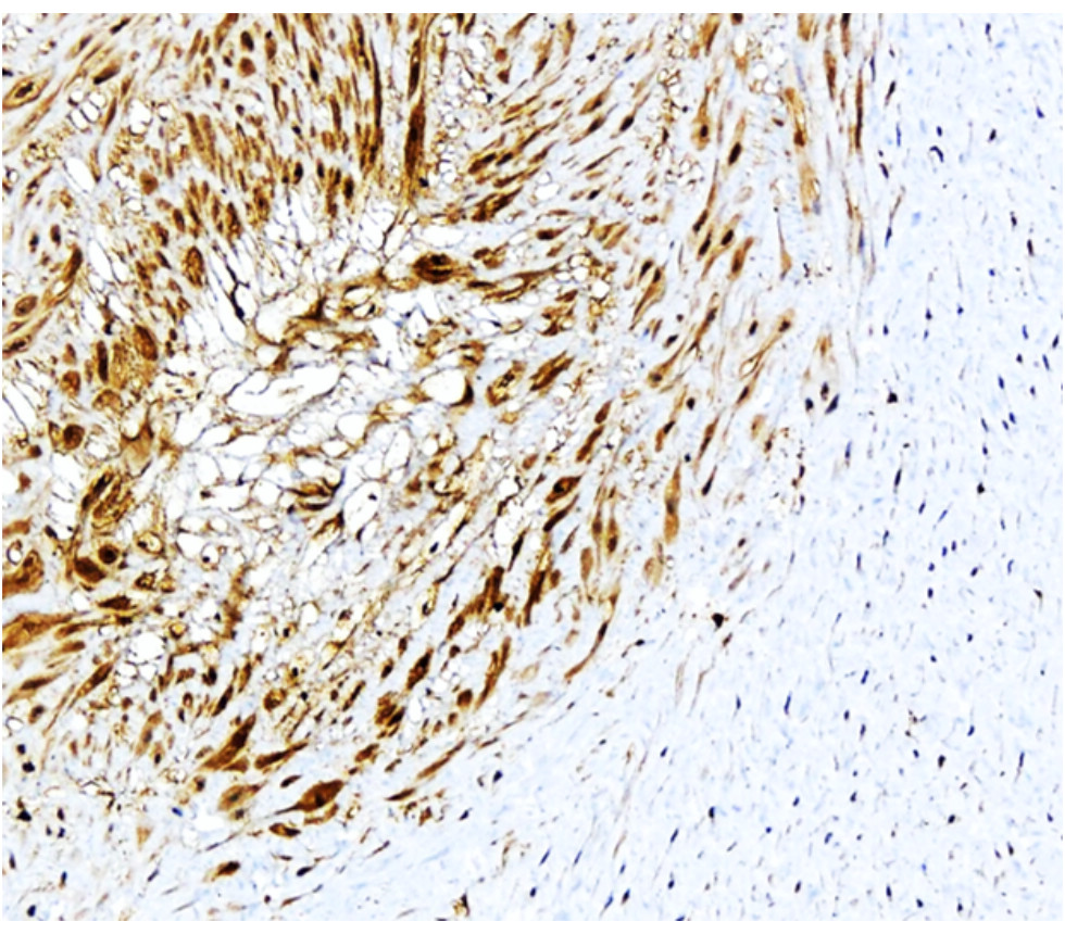 IR307-912 anti P-selectin / CD62P antibody IHC image IR307-912 anti P-selectin / CD62P antibody IHC image