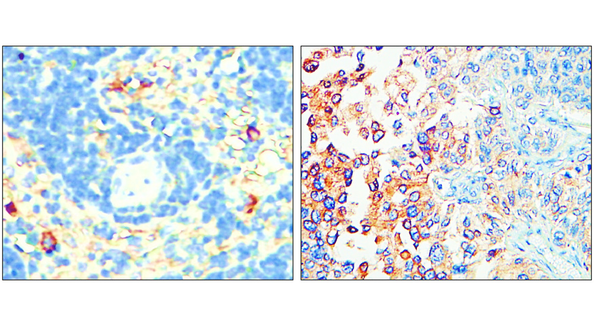 IR307-912 anti P-selectin / CD62P antibody IHC image IR307-912 anti P-selectin / CD62P antibody IHC image