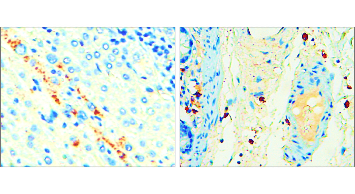 IR307-912 anti P-selectin / CD62P antibody IHC image IR307-912 anti P-selectin / CD62P antibody IHC image
