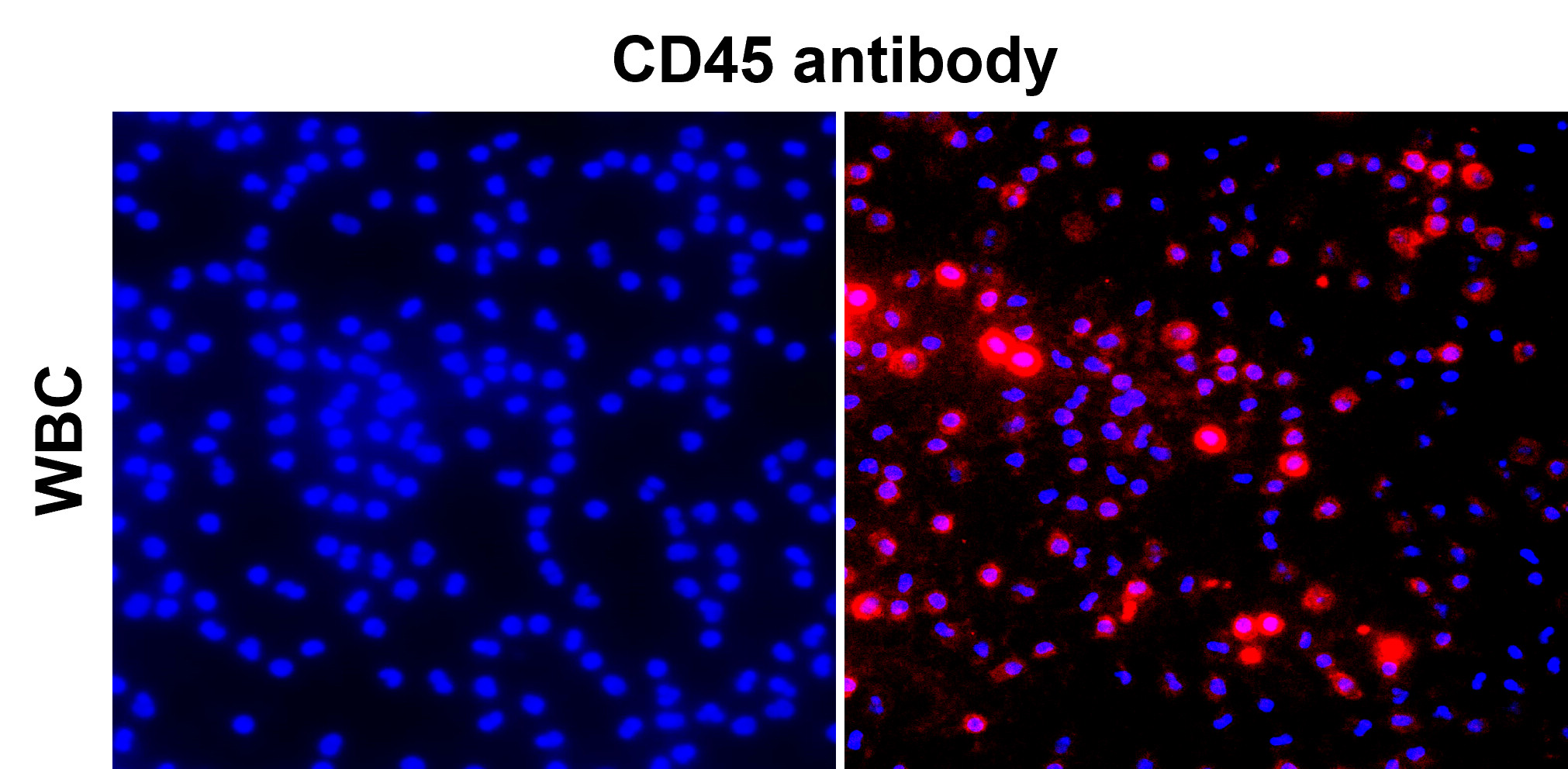 IR77-264 anti-CD45 antibody_WBC ICC/IF image