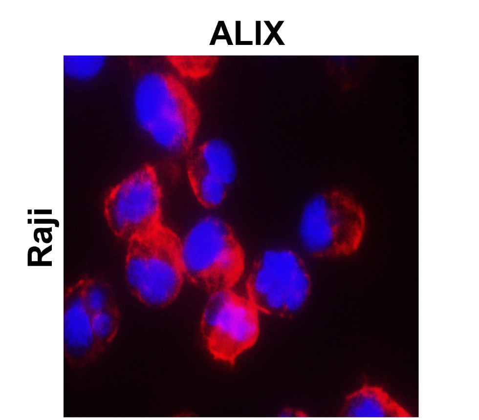 IR303-988 anti-ALIX antibody ICC/IF image IR303-988 anti-ALIX antibody ICC/IF image