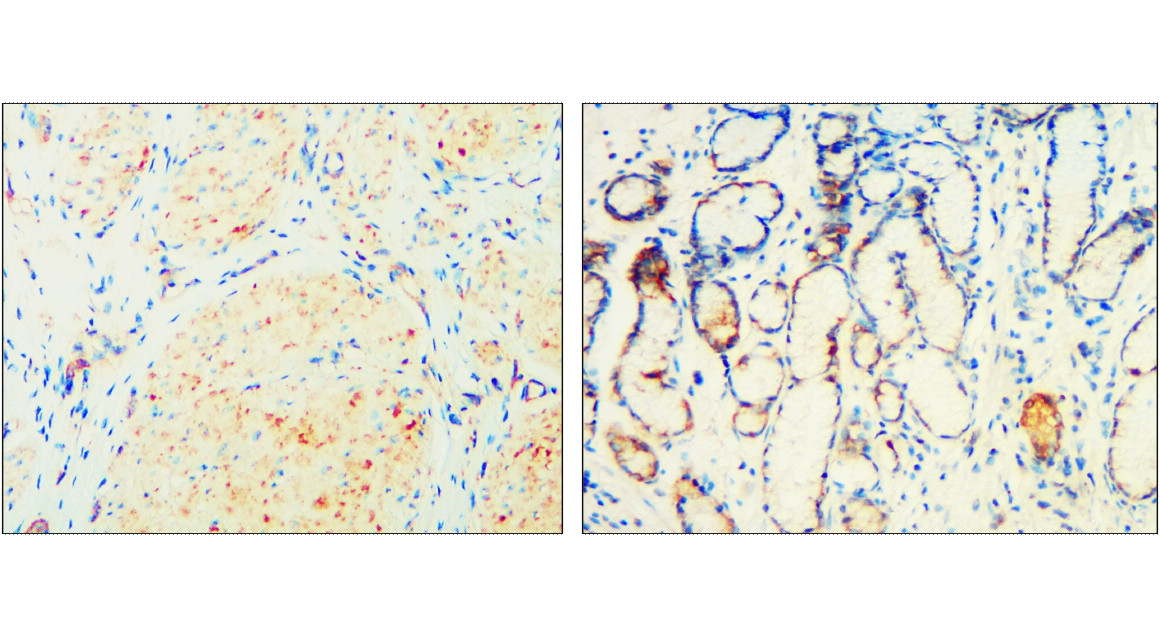 IR303-988 anti-ALIX antibody IHC image IR303-988 anti-ALIX antibody IHC image
