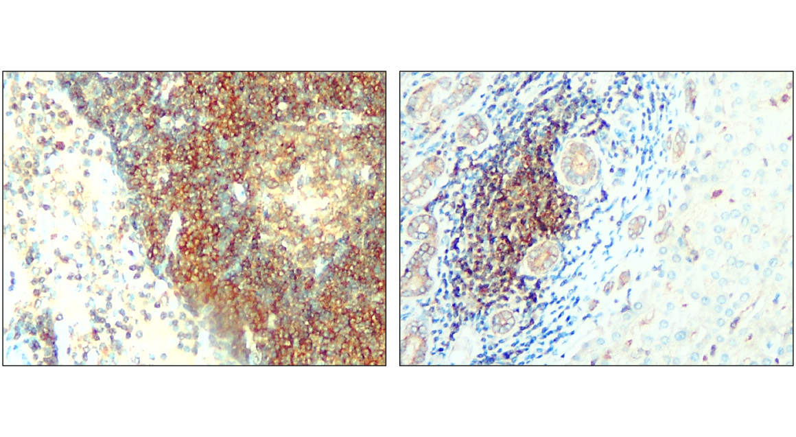 IR303-988 anti-ALIX antibody IHC image IR303-988 anti-ALIX antibody IHC image