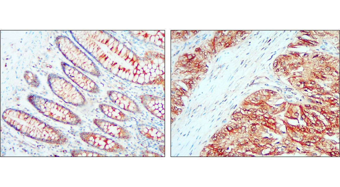 IR303-988 anti-ALIX antibody IHC image