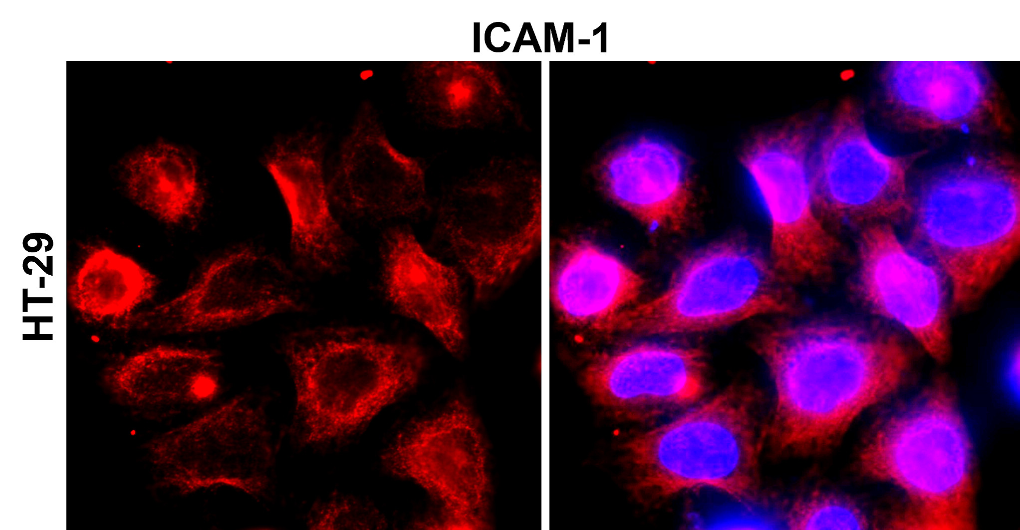 IR78-268 anti-ICAM-1 / CD54 antibody_HT-29 ICC/IF image IR78-268 anti-ICAM-1 / CD54 antibody_HT-29 ICC/IF image