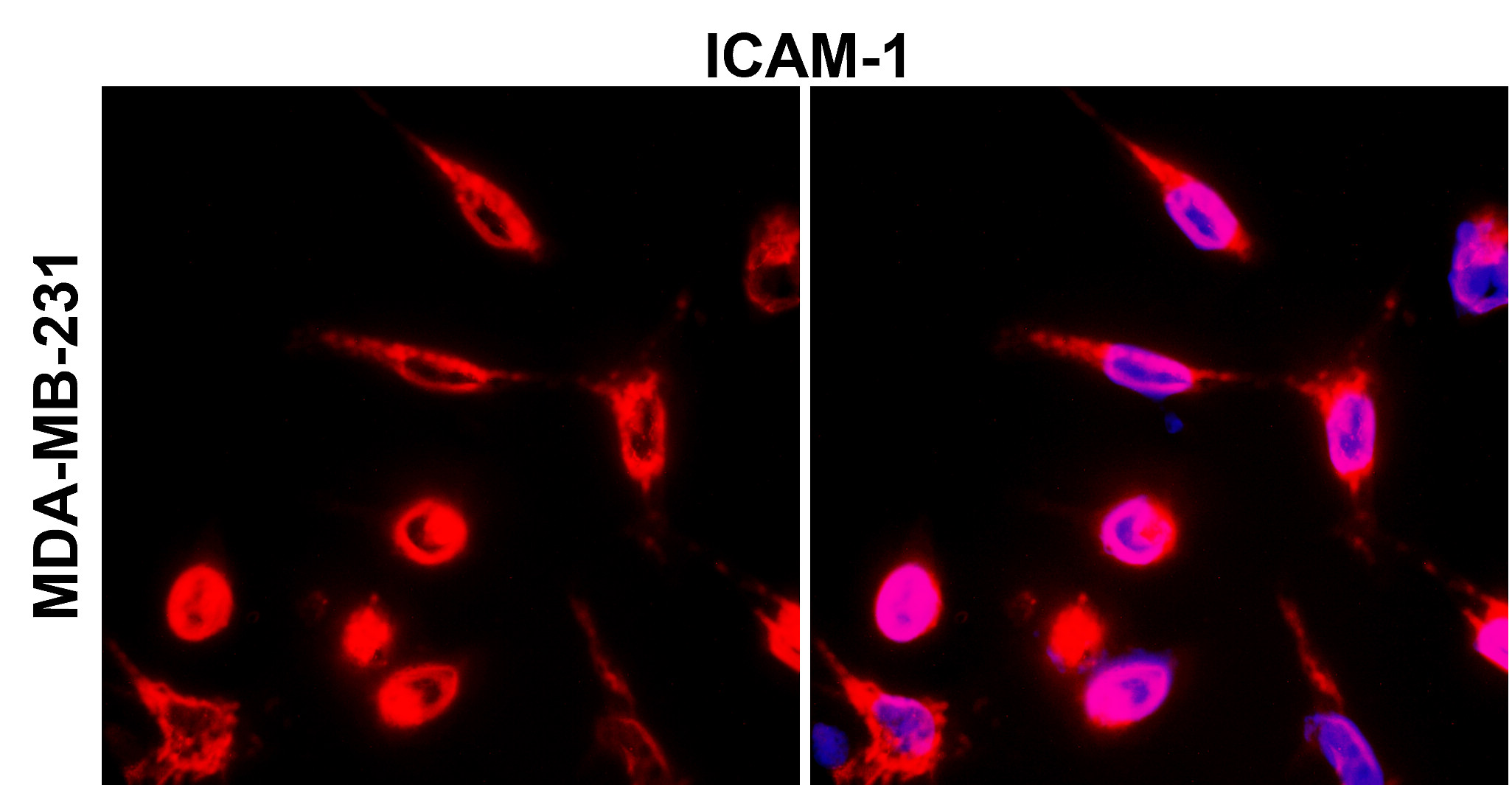 IR78-268 anti-ICAM-1 / CD54 antibody_MDA-MB-231 ICC/IF image IR78-268 anti-ICAM-1 / CD54 antibody_MDA-MB-231 ICC/IF image