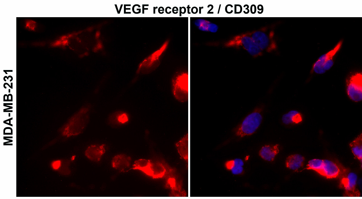 IR81-279 anti-VEGF Receptor 2 antibody ICC/IF image