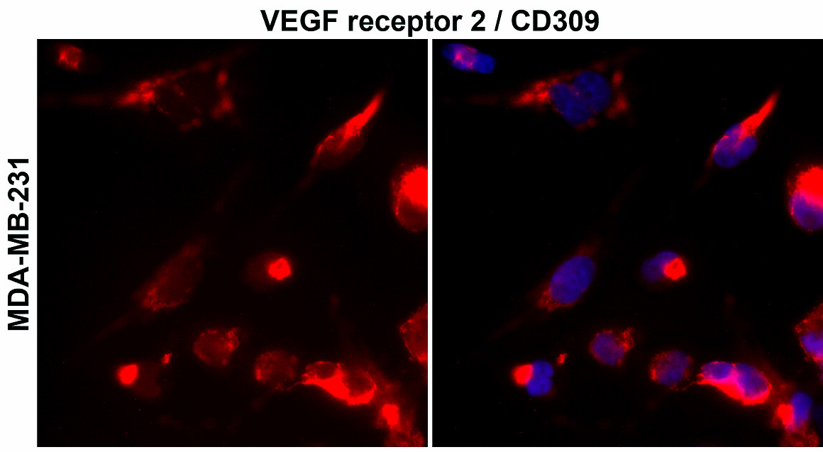 IR81-279 anti-VEGF Receptor 2 antibody ICC/IF image IR81-279 anti-VEGF Receptor 2 antibody ICC/IF image
