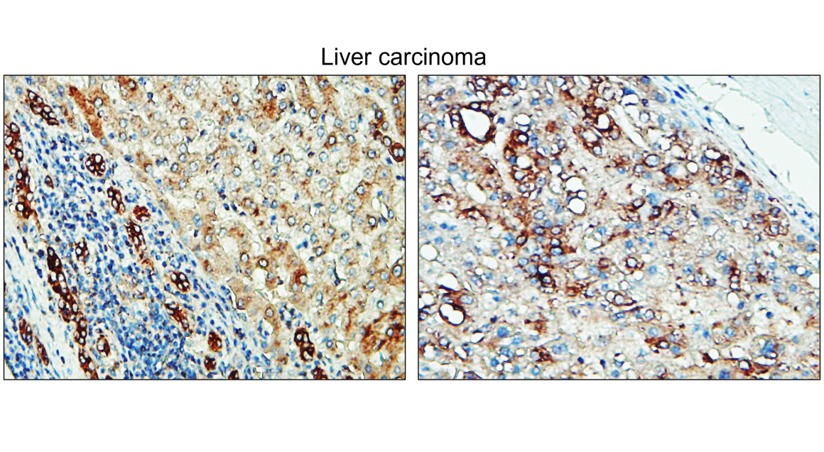 IR295-1 anti-Tissue Factor / CD142 antibody IHC image