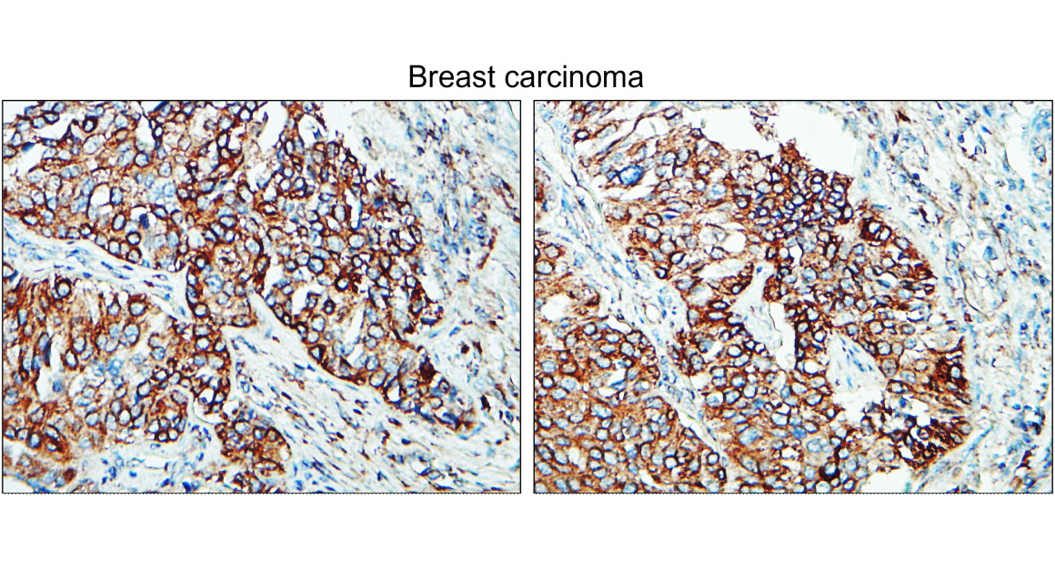 IR295-1 anti-Tissue Factor / CD142 antibody IHC image IR295-1 anti-Tissue Factor / CD142 antibody IHC image