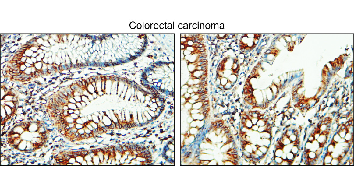 IR295-1 anti-Tissue Factor / CD142 antibody IHC image IR295-1 anti-Tissue Factor / CD142 antibody IHC image