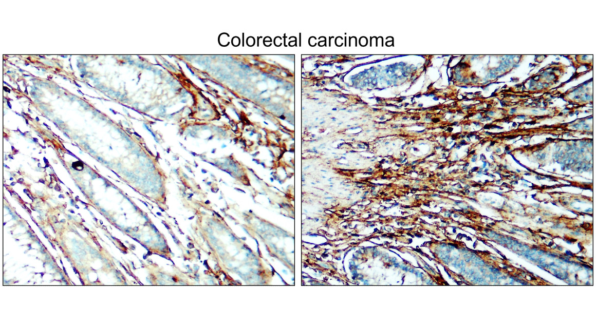 IR292-962 anti-COL1A1 / Collagen I antibody IHC image