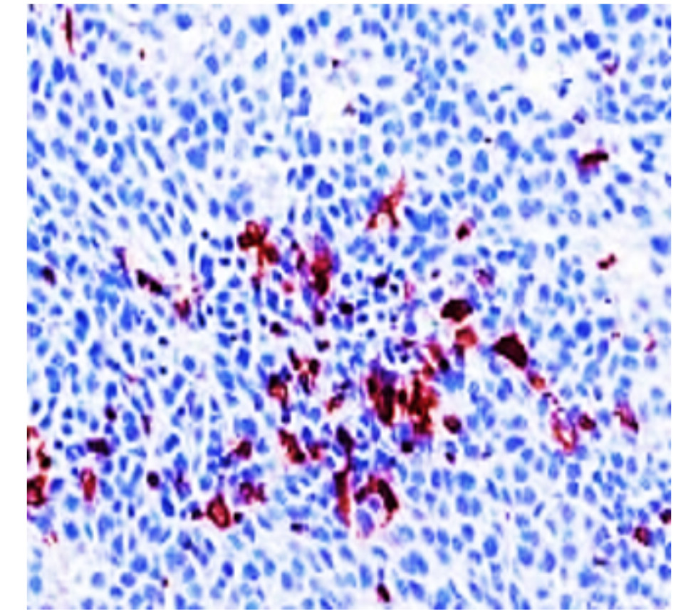 Customer feedback Image IR257-914 anti-CD11b / ITGAM antibody IHC image Customer feedback Image IR257-914 anti-CD11b / ITGAM antibody IHC image